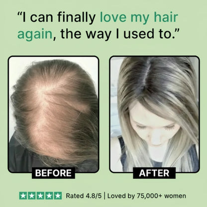 Klyvora – Root Revival Serum™